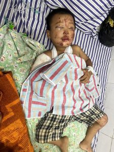 Read more about the article မုန်လိုင်ခက် လက်နက်ကြီးနဲ့ လေကြောင်းတိုက်ခက်မူ